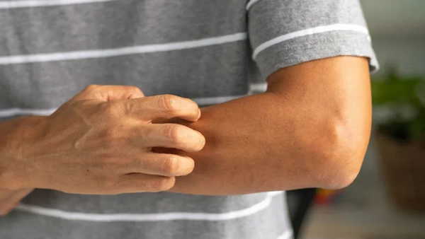 Vücudunuzdaki Kaşıntıyı İhmal Etmeyin: Onkologlardan Önemli Uyarılar